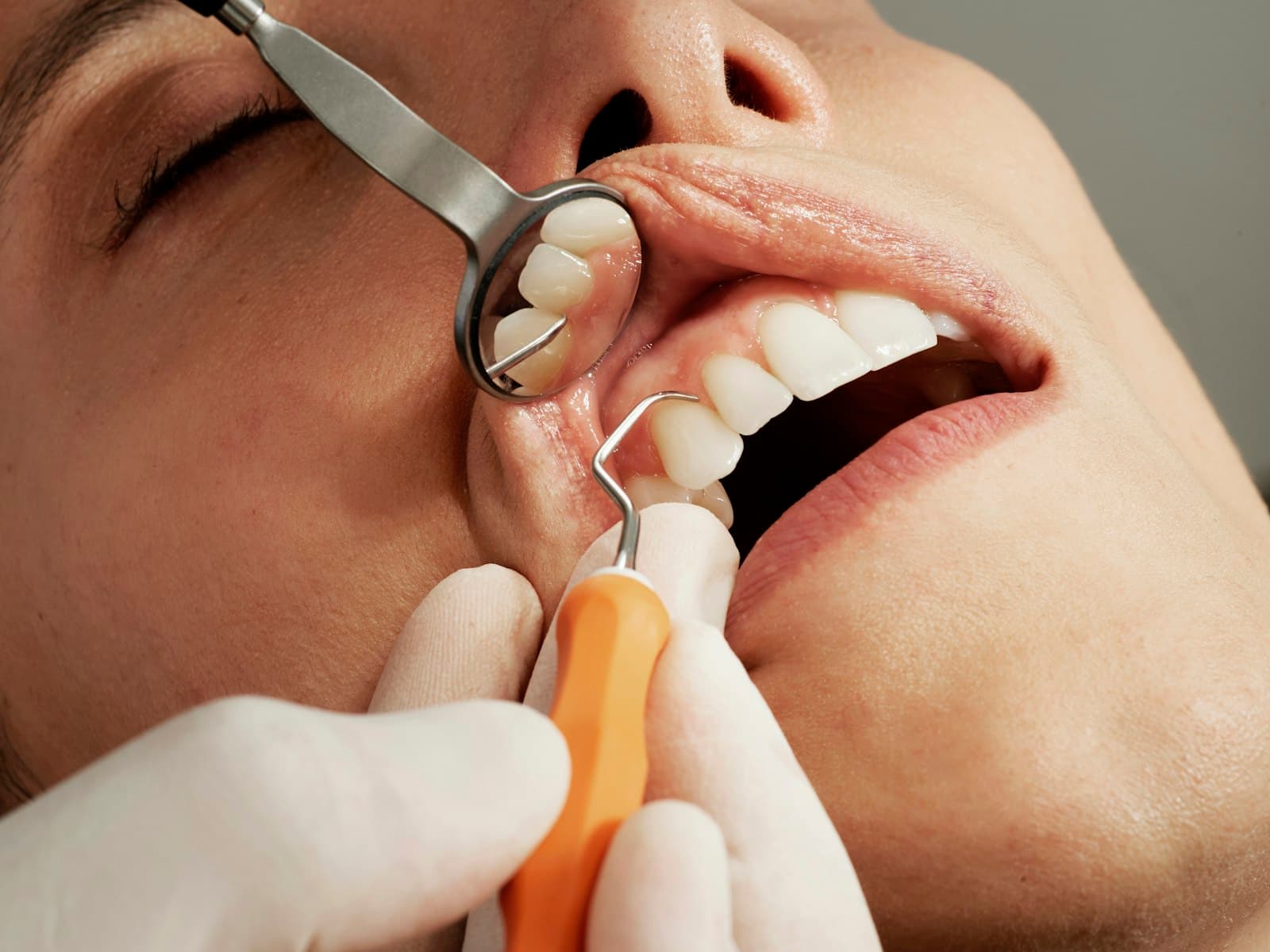 Procedimiento odontológico — examen y limpieza dental